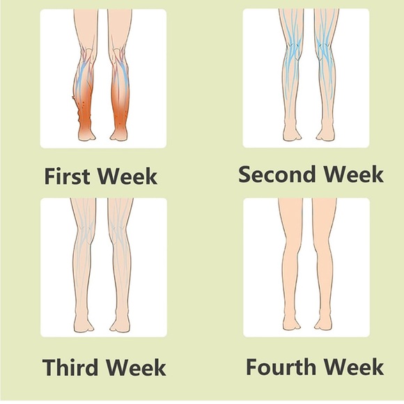 Wireless Calf Massager, Leg Compression Circulation Muscle Fatigue Relaxation - Picture 4 of 7